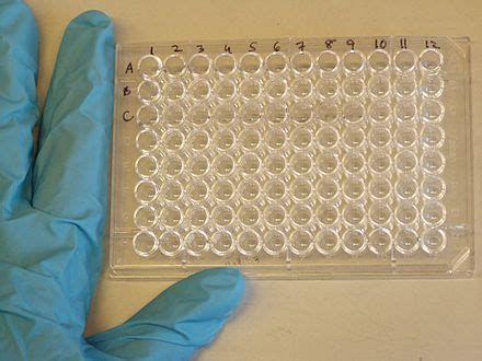 test elisa jak wyglada|ELISA (test immunoenzymatyczny) – Wikipedia, wolna encyklopedia.